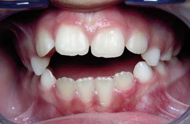 Nieuwe specialisatie Nieuwe specialisatie